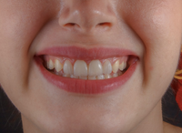 Parodontologie in der Zahnarztpraxis Ochinko