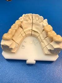 Zahnersatz in der Zahnarztpraxis Ochinko