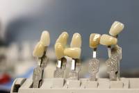 Zahnersatz in der Zahnarztpraxis Ochinko