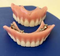 Moderne Zahn&auml;sthetik in der Zahnarztpraxis Ochinko!