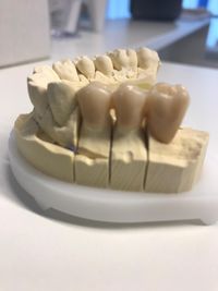 Zahnarztpraxis Ochinko_Zahnersatz